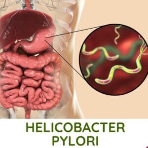 Helicobacter pylori w naszym organiźmie